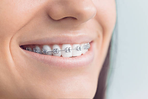 Best Wisdom Tooth Removal  in Loxley, AL